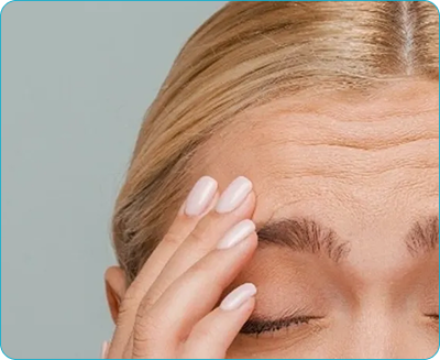 Forhead Lines